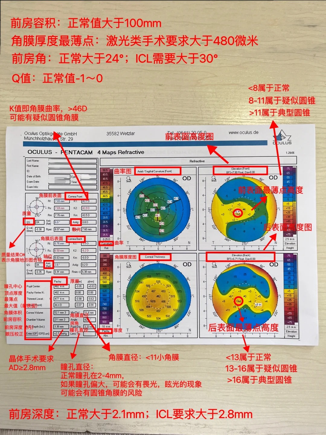 一張圖帶你看懂角膜地形圖的數(shù)據(jù)??_1_小愛護(hù)眼日記_來自小紅書網(wǎng)頁版